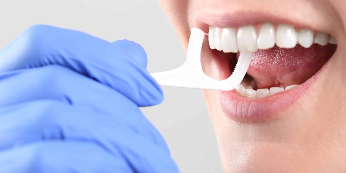Professionelle Zahnreinigung (Zahnprophylaxe) – Behandlung und Ablauf