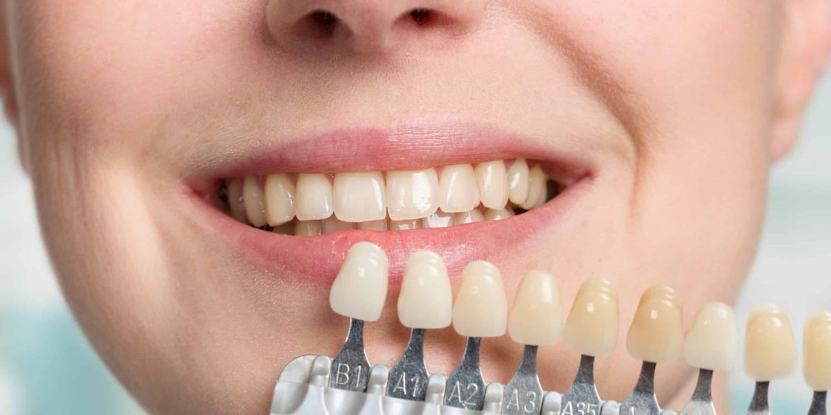 Minimalinvasive ästhetische Eingriffe für ein strahlendes Lächeln